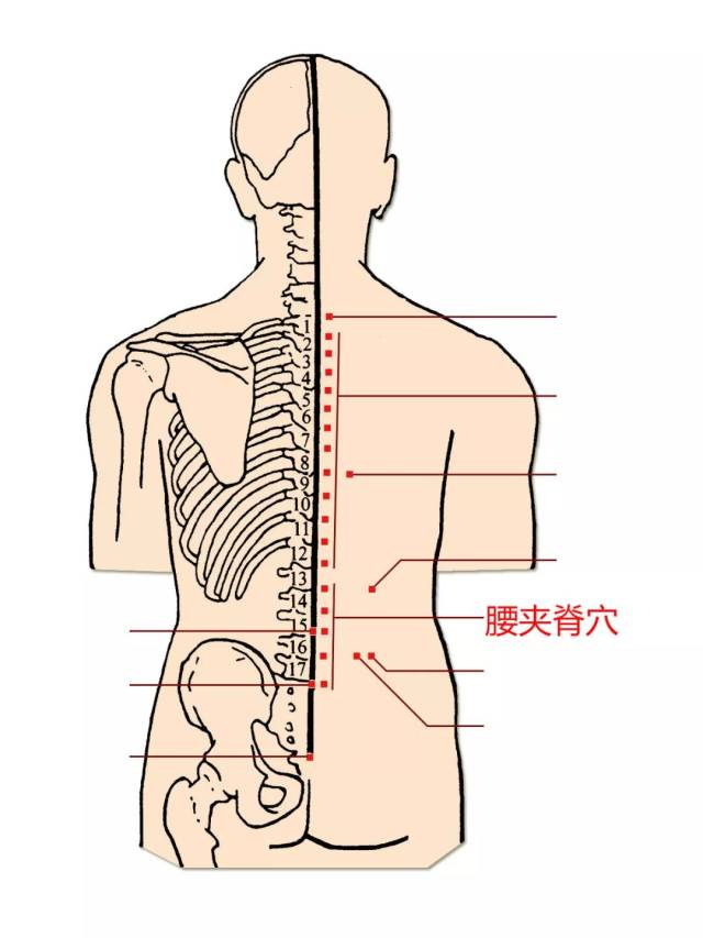 "坐立难安"?针灸助您缓解坐骨神经痛