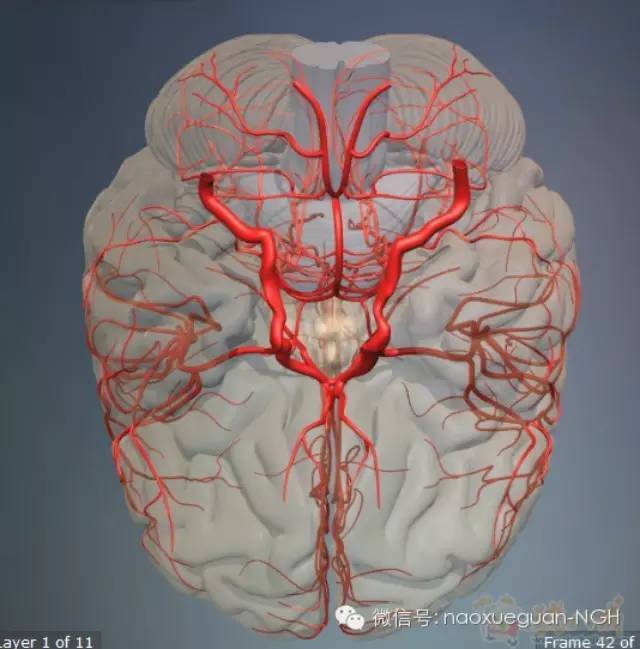 脑血管病的检查知多少?