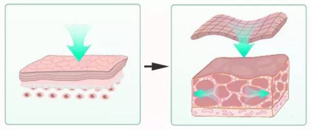不刺激 渗透性强 吸收速度快,直达皮下组织 看水分测试 使用前肌肤含