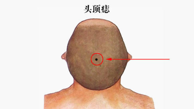 男人最有福气的10处吉痣长在哪?