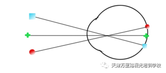 天津万里路视光培训学校:同侧性复视,交叉性复视_手机搜狐网