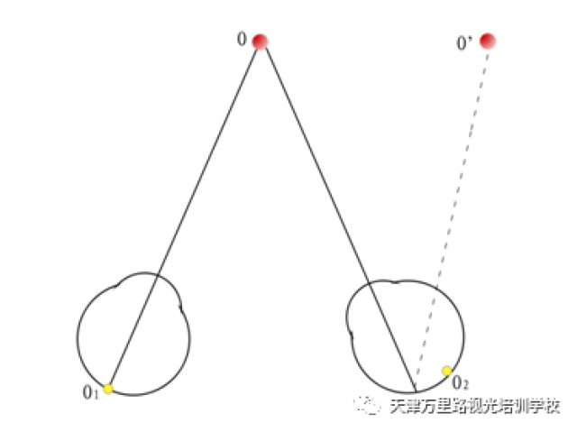 天津万里路视光培训学校:同侧性复视,交叉性复视