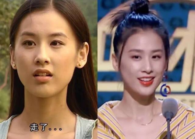 大s为美白吃抗凝血剂?女明星