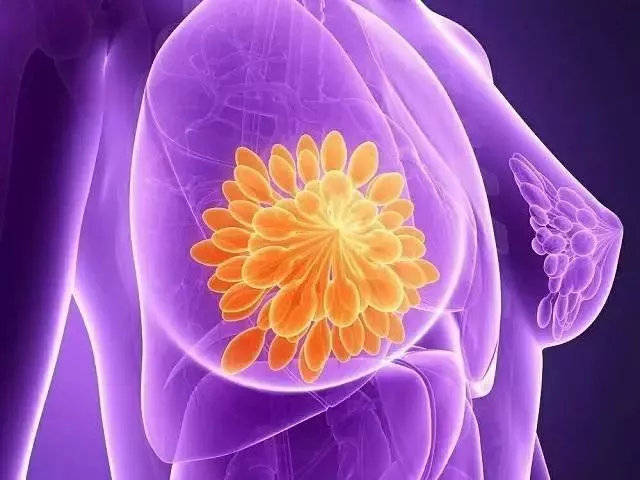 乳腺肿块平时女性要经常的观察自己的乳房状况,在按摩乳房时,如发现有