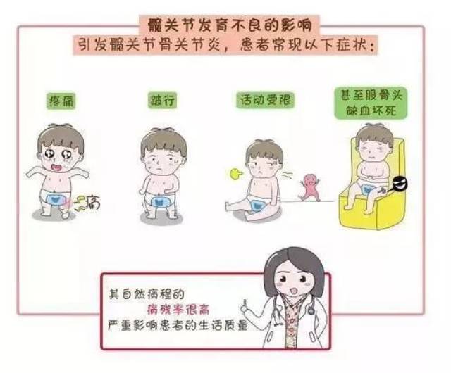 当心!宝宝腿上褶子不对称,骨骼发育或有问题