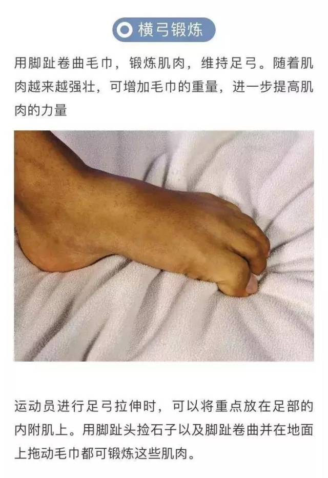 弓形足的人经常跑动很容易引起足弓拉伤导致足底筋膜炎.