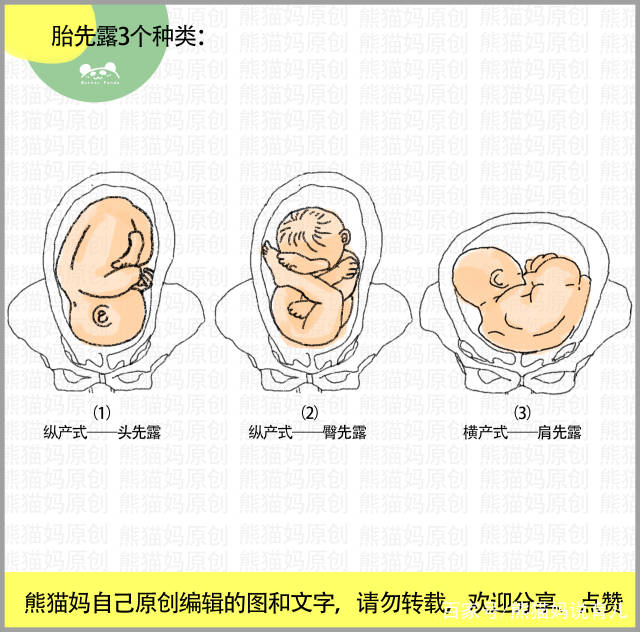 胎位(胎姿势)就是宝宝在妈妈子宫里面的位置,而宝宝最先进入骨盆入口