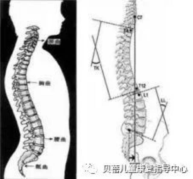 小心孩子"弓背"毁终生