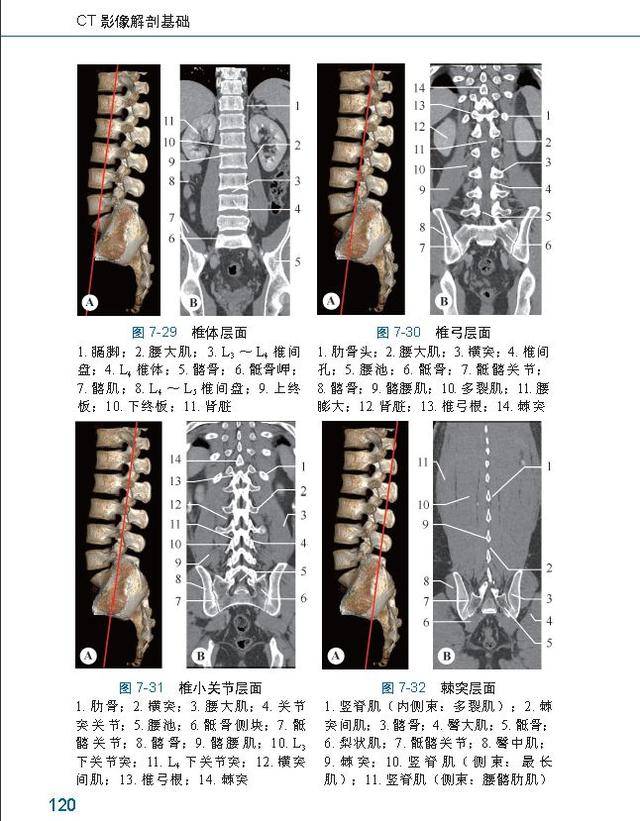 ct影像解剖基础——我是"ct快速入门丛书"老八,我也同样精彩!