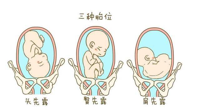 2,代表骨名称,如顶先露为"枕",即"o",臀先露为"骶",即"s",面先露为"