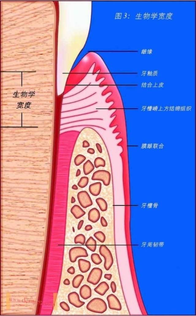 牙齿杀神经根管治疗后一定要带个套保护起来