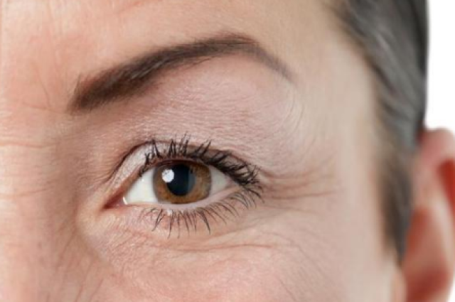 轻松搞定上眼皮松弛下垂的2种方法