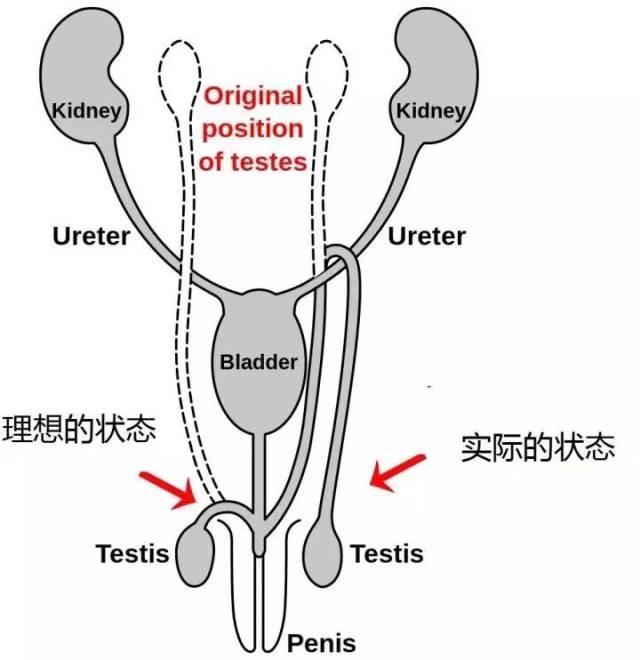 你把我的喉返神经弄得绕一大圈也就罢了,我的输精管为什么也饶了这么