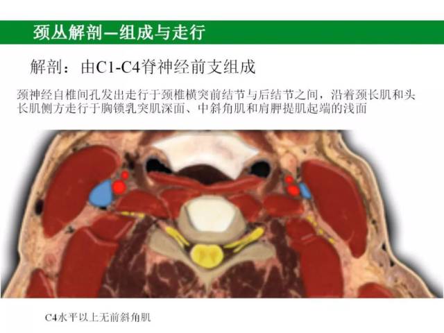 【神经阻滞第一弹】超声引导下颈丛阻滞在甲状旁腺手术中的应用