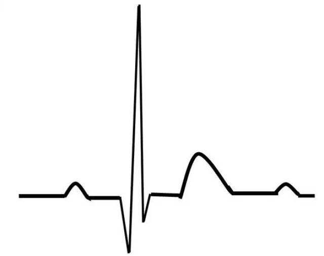 【心电图】基础心电图速成大法-------心电图速成
