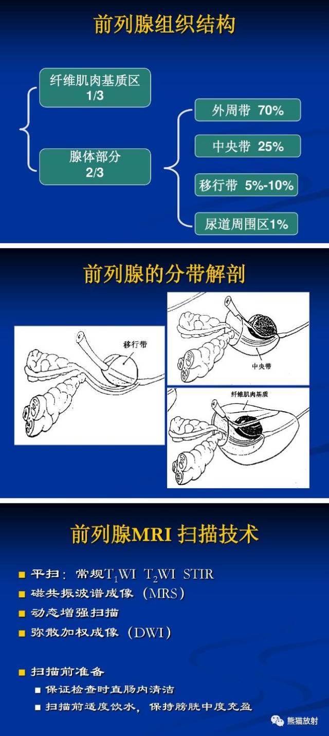 前列腺丨mri扫描及诊断:相关知识点