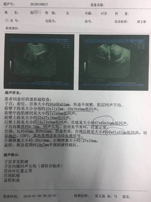 交谈中,笔者得知,张女士10多年也没做过检查,一直感觉自己身体很健康