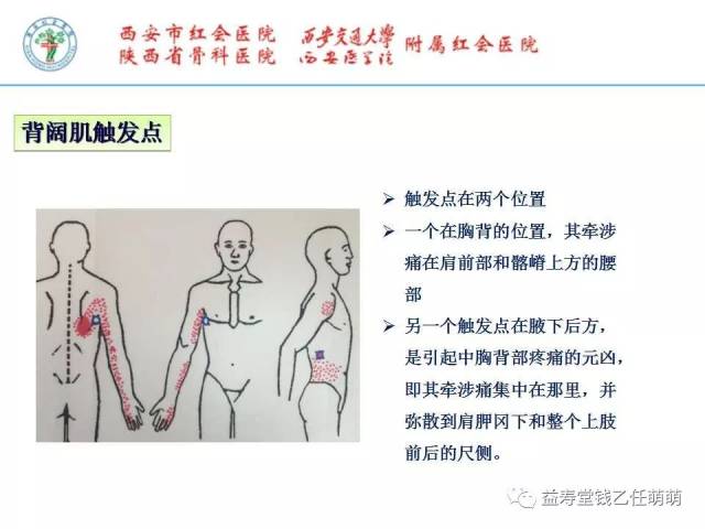 颈背部疼痛的肌筋膜触发点冲击波疗法