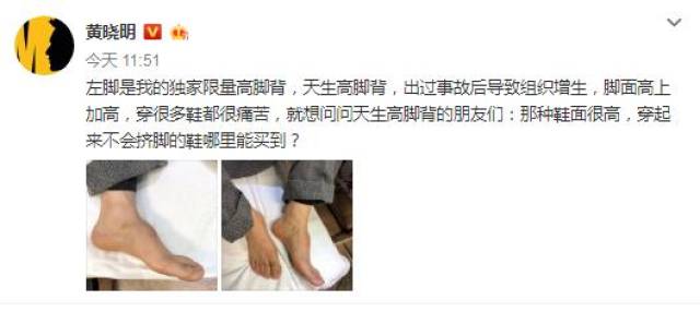 聪明哇!黄晓明很无辜的微博咨询不挤脚的鞋,真实目的竟是为这!