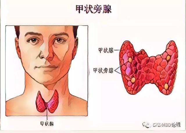 我与甲状旁腺射频消融的"第一次亲密接触"