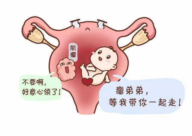 子宫肌瘤对怀孕的影响有多大?需要做手术吗?