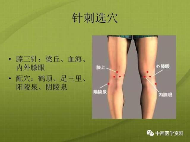 膝关节针灸治疗