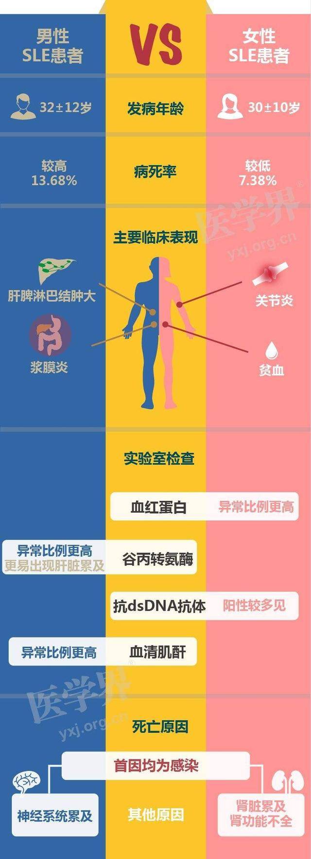 揭开系统性红斑狼疮致病机制的面纱