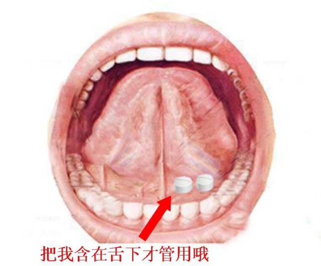 舌下含服的吸收率会达到80%. 2.连续服用3片无效后,应拨打120.