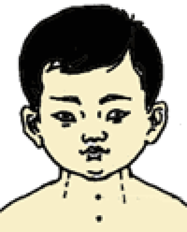 小儿推拿全系列(附动态图)