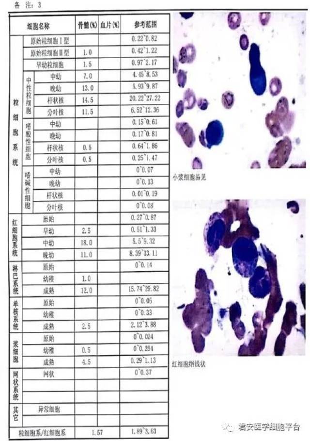 骨髓像形态描述 骨髓小粒易见,取材制片染色佳,有核细胞量稍偏少.