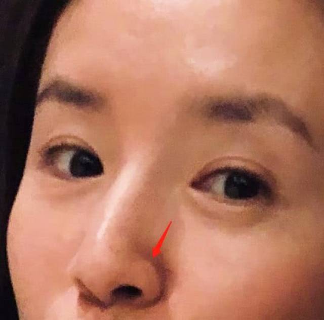 这次董洁鼻子上的大黑头真的恶心到我了