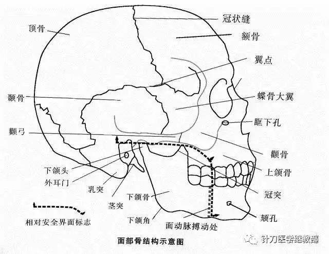 眶上孔(切迹) 位于眶上缘中,内1/3交界处,距中线约25mm.