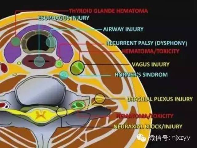 【医学科普】新中医诊疗体系下的星状神经节阻滞详解!