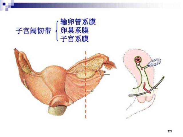 手术中发现原来是右侧输卵管系膜囊肿,扭转了720°,但卵巢外观没有