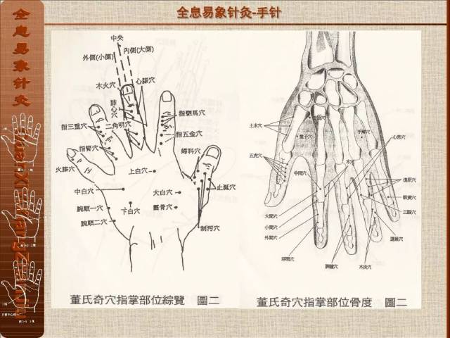 全息易象针灸-董氏奇穴