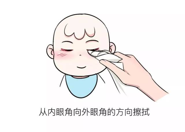第二步:清洁宝宝的眼睛