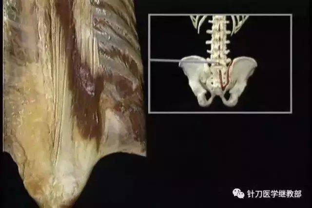 疼痛的大门-髂后上棘内上缘及骶髂关节内侧缘的应用解剖