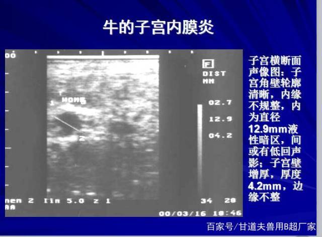 母牛子宫内膜炎超声影像特征