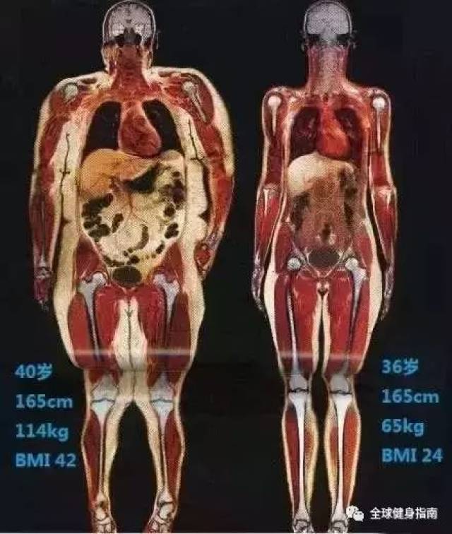 胖子和瘦子的差别 并不在于体重 而是体脂率 即人体内脂肪重量 占人体