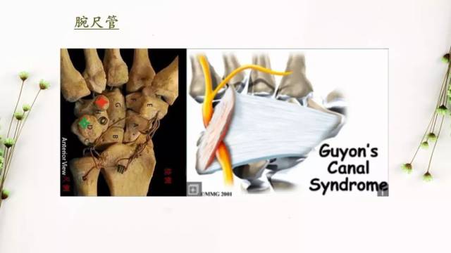 尺骨鹰嘴头之间的弓状韧带和尺神经沟围成的骨性纤维性鞘管所组成的