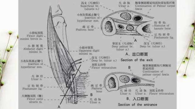 尺骨鹰嘴头之间的弓状韧带和尺神经沟围成的骨性纤维性鞘管所组成的