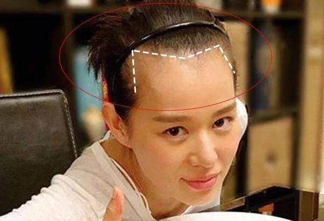 发际线高,且不适合留刘海 很多人扎马尾不好看,有一部分是因为发际线