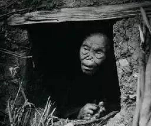 【关注】2019年1月27日 第66届“世界防治麻风病日