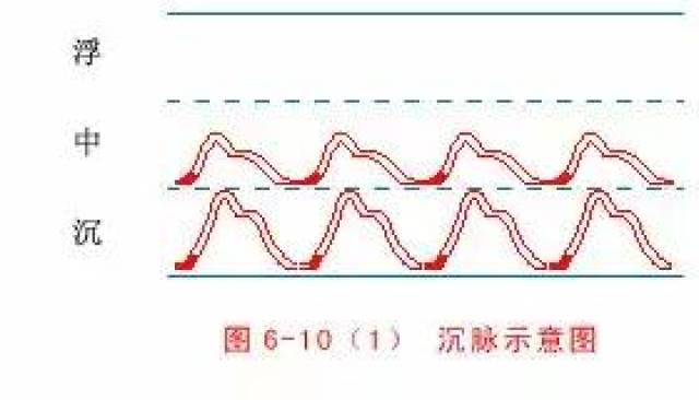 微脉:细微小至如弦,沉而极细最不断,春夏少年均不宜,春冬老弱确为善.