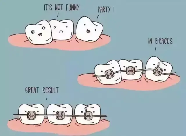 牙齿矫正有年龄限制吗?