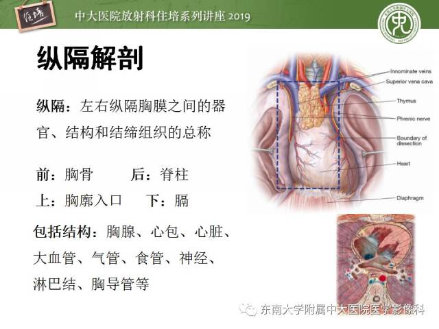 【2018住培系列讲座 第47期】纵隔分区及常见纵隔占位的影像诊断