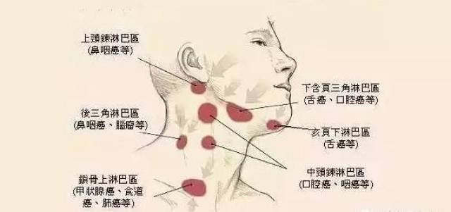 【养生】是时候测测淋巴有多堵了?当心它会无声地爆发