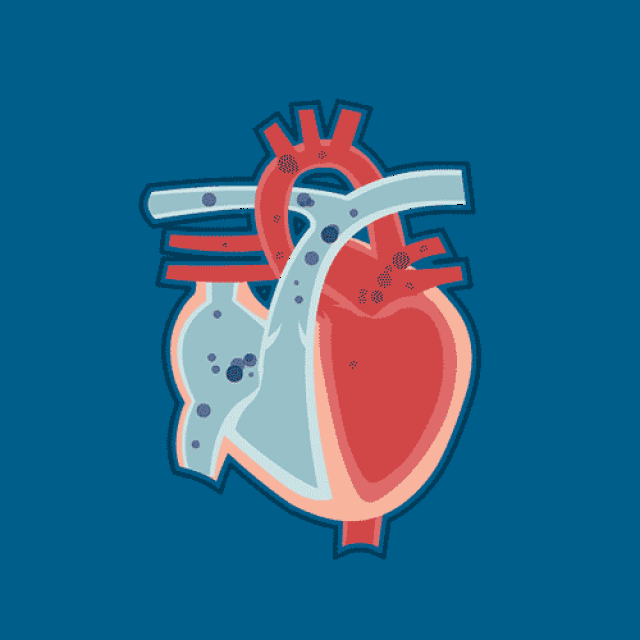 【收藏】心脏瓣膜置换术后五大注意事项