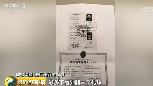 25岁女孩整容成歪嘴:毁了我一生!医院只赔500