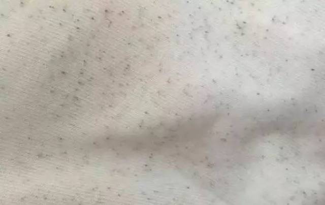 衣服出现黑点,不用漂白水就可以清理干净!